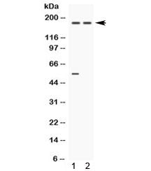 Ceruloplasmin Antibody / CP