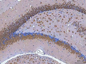 IHC staining of FFPE mouse brain tissue with Rbfox3 antibody. HIER: boil tissue sections in pH8 EDTA