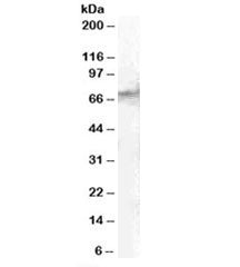 Western blot testing of human spleen lysate with STAM2 antibody at 1ug/ml. Predicted molecular weigh