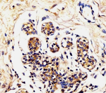 IHC testing of FFPE human breast tissue with Alpha Lactalbumin antibody. HIER: steam section in pH6