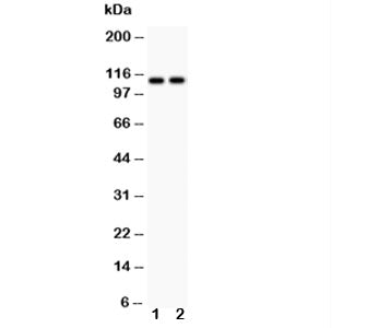 Western blot testing of ATP2A3 antibody and Lane 1: rat skeletal muscle; 2: mouse skeletal muscle; Predicted size: 114KD; Observed size: 114KD