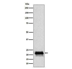 FSH beta Antibody