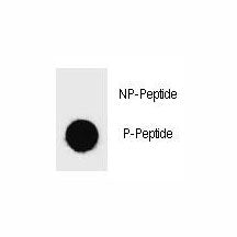 Phospho-BAD Antibody (pS25)