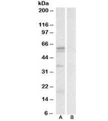 LAT1 Antibody