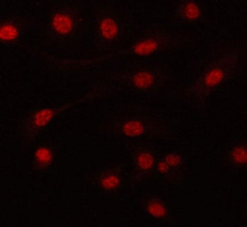 PRPF6 Antibody / Pre-mRNA processing factor 6