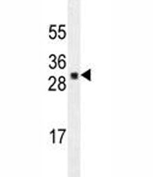 UBTD1 Antibody, 0.08ml