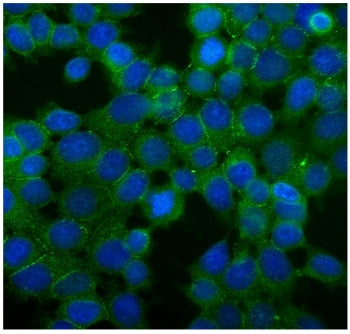 Immunofluorescent staining of FFPE human MCF7 cells with Desmoglein 2 antibody (green) and DAPI (blu