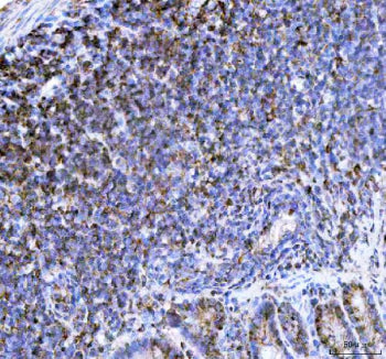 Immunohistochemical staining of NCF1 using anti- NCF1 antibody. NCF1 was detected in a paraffin-embe