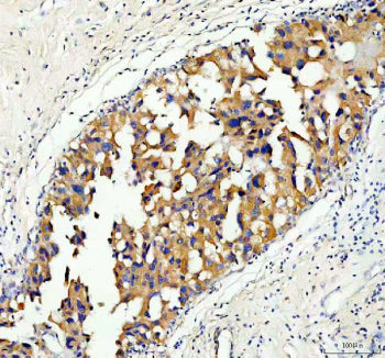 Immunohistochemical staining of Serine racemase using anti-Serine racemase antibody. Serine racemase
