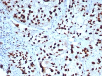 GATA3 Antibody