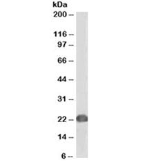 Western blot testing of human Jurkat lysate with biotinylated DJ-1 antibody at 0.2ug/ml. Predicted m