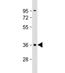 PLK5 Antibody / Polo-like kinase 5