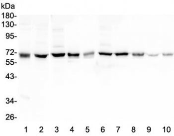 HAS1 Antibody / Hyaluronan synthase 1