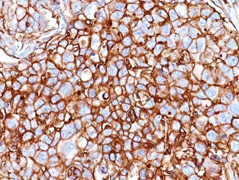 CD44 Antibody / HCAM