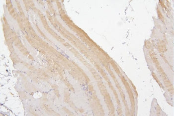 Tafazzin Antibody / TAZ