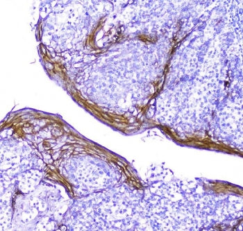 Periplakin Antibody