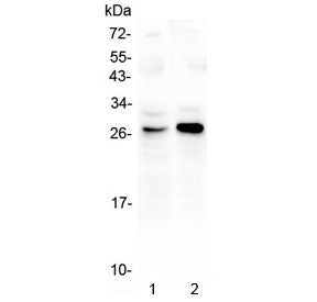 Western blot testing of 1) rat kidney and 2) mouse kidney using GITR antibody at 0.5ug/ml. Predicted