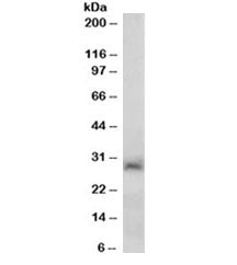 Western blot testing of human liver lysate with SIRT3 antibody at 0.2ug/ml. Predicted molecular weig