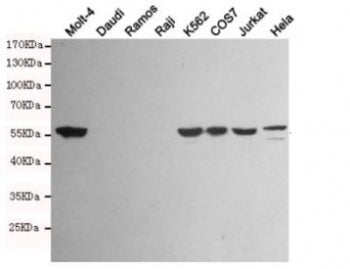 Vimentin Antibody