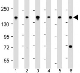 Western blot testing of human 1) 293T/17, 2) DU-145, 3) LNCaP, 4) Raji, 5) U-2OS and 6) HeLa cell ly