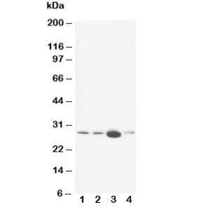 Western blot testing of Calbindin antibody and Lane 1: rat brain; 2: rat brain; 3: rat kidney; 4: ra