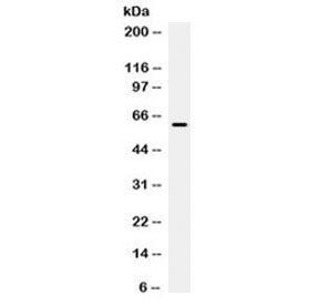 Western blot testing of human HeLa cell lysate with PD-L1 / B7-H1 antibody at 0.5ug/ml. Expected molecular weight ~34/40-70 kDa (unmodified/glycosylated), observed here at ~62 kDa.