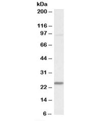 Western blot testing of mouse heart lysate with NDUFS8 antibody at 0.1ug/ml. Predicted molecular wei