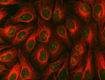 SITAC Antibody / SDCBP2 / Syntenin-2