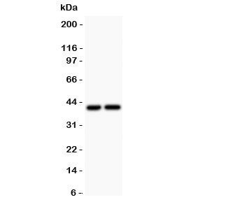 Western blot testing of CXCR3 antibody and Lane 1: COLO320; 2: SGC lysate. Predicted molecular weigh