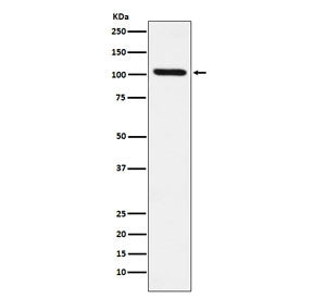 RIG-I Antibody / DDX58