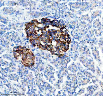 IHC analysis of TRIM58 using anti-TRIM58 antibody. TRIM58 was detected in a paraffin-embedded sectio