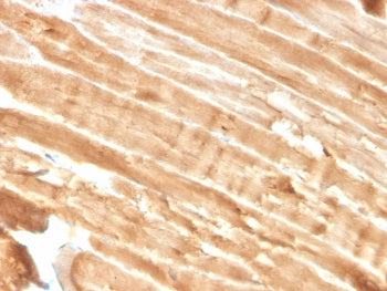 IHC staining of FFPE skeletal muscle with Dystrophin antibody (clone DMD/3244). HIER: boil tissue se