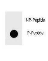Phospho-PARP1 Antibody (pS864)