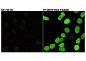 Immunofluorescent staining of mouse NIH 3T3 cells untreated (left) and treated (right) with Hydroxyu