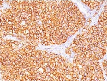 CA9 Antibody / Carbonic Anhydrase IX