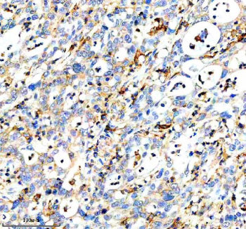 Immunohistochemical staining of DOCK8 using anti-DOCK8 antibody. DOCK8 was detected in a paraffin-em
