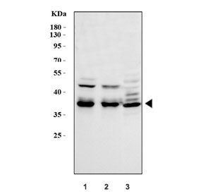 Western blot testing of 1) human HeLa, 2) human A549 and 3) rat C6 cell lysate with MEK6 antibody at