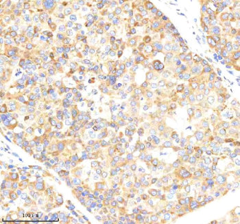 Immunohistochemical staining of NCLN using anti-NCLN antibody. NCLN was detected in a paraffin-embed