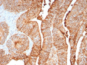 CDH17 Antibody / Cadherin 17
