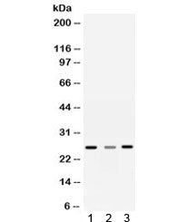 Western blot testing of 1) rat liver, 2) rat brain and 3) human SMMC-7721 lysate with Sorcin antibod