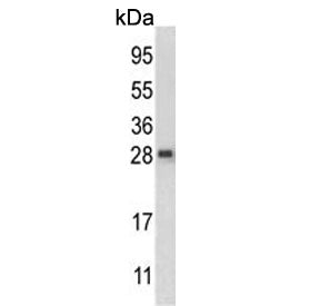QDPR Antibody / Dihydropteridine reductase
