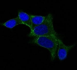 IF staining of LNCap cells using AF488 labeled Ornithine Decarboxylase antibody (ODC1/487) (Green).