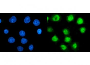 Immunofluorescent staining of FFPE human MCF7 cells with PSMC3 antibody (green) and DAPI nuclear sta