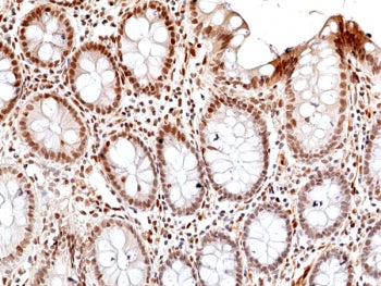 Phosphorylated JNK Antibody / pThr183/pTyr185