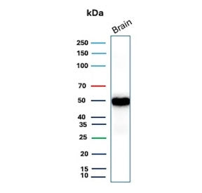 Western blot testing of human brain tissue lysate with recombinant GFAP antibody (clone rGFAP/9150).