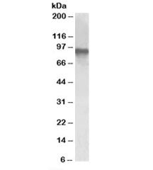 Western blot testing of Jurkat lysate with CRTC2 antibody at 1ug/ml. Predicted molecular weight: ~73