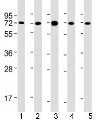 Western blot testing of human 1) MCF-7, 2) PC-3, 3) COS-7, 4) DU-145 and 5) SK-BR-3 cell lysate with