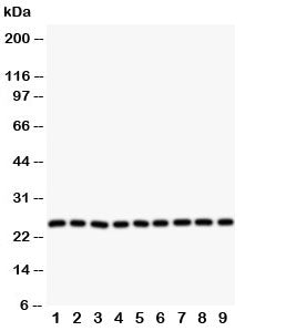 Western blot testing of SOD2 antibody and Lane 1: rat liver; 2: (r) intestine; 3: (r) lung; 4: (r) h