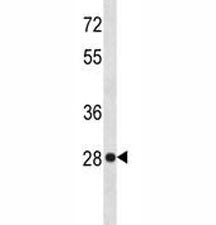 HMGB-1 Antibody