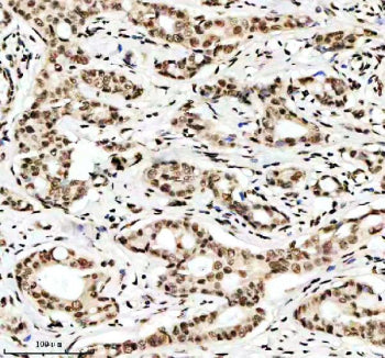 Immunohistochemical staining of Histone H3 (acetyl K9) using anti-Histone H3 (acetyl K9) antibody. H